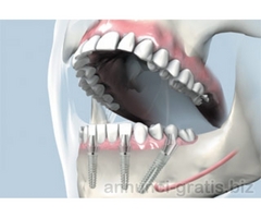 CROAZIA DENTISTI A PREZZI VANTAGGIOSI
